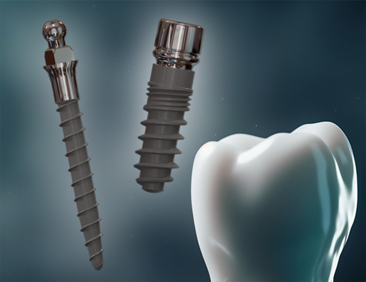 Grafik Mini Implantat